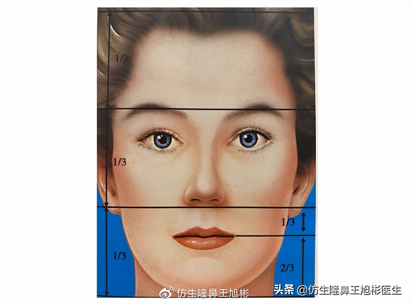 大宽朝天鼻整形过程,窄鼻子如何通过鼻整形来矫正