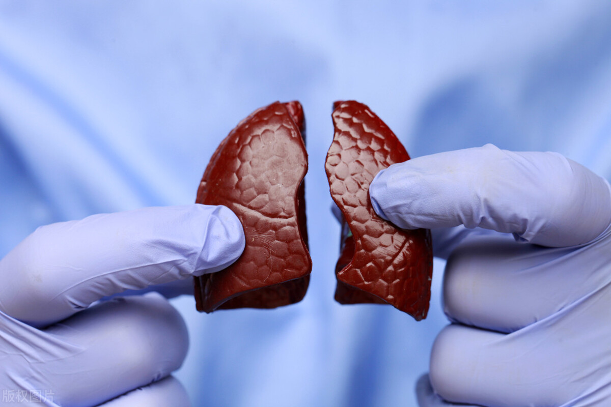 肺结节吃什么可以散结张仲景的药,肺结节张仲景