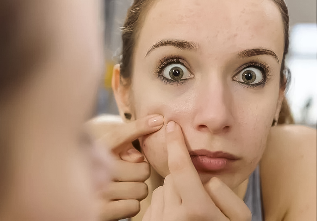 清粉刺疼不疼,清粉刺后红肿什么时候消