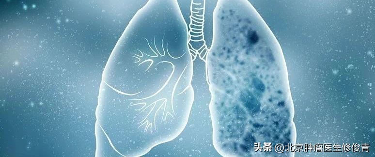 治肺结节软坚散结的药材有哪几种,消除肺结节用软坚散结的是什么药