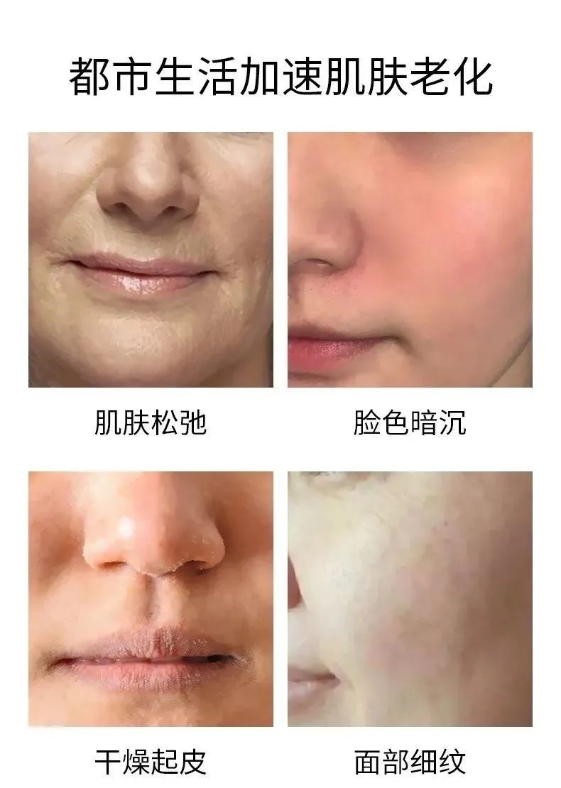 韩国ahc铂金面膜,韩国ahc面膜用法