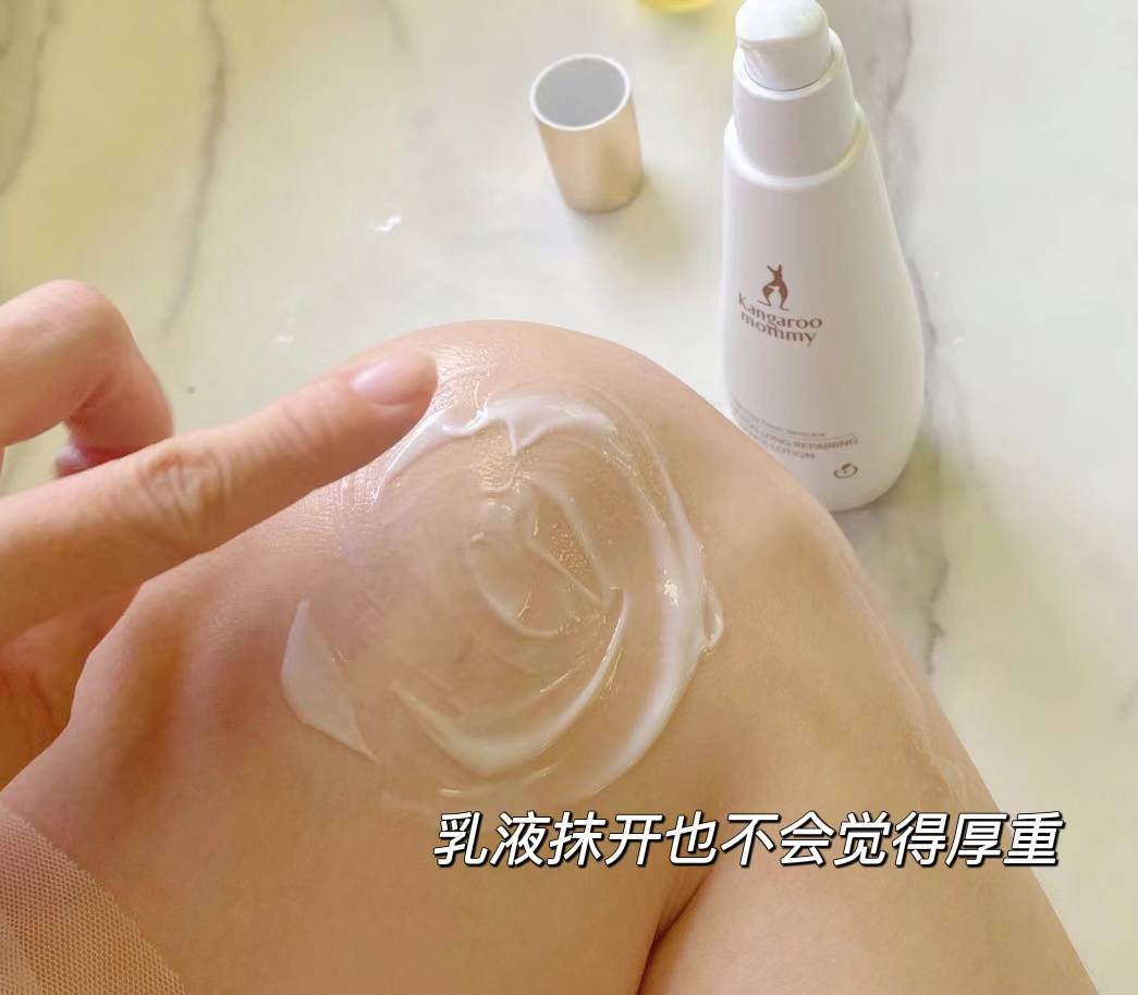 肥胖纹目前最好的去除办法,淡化肥胖纹修复肥胖纹