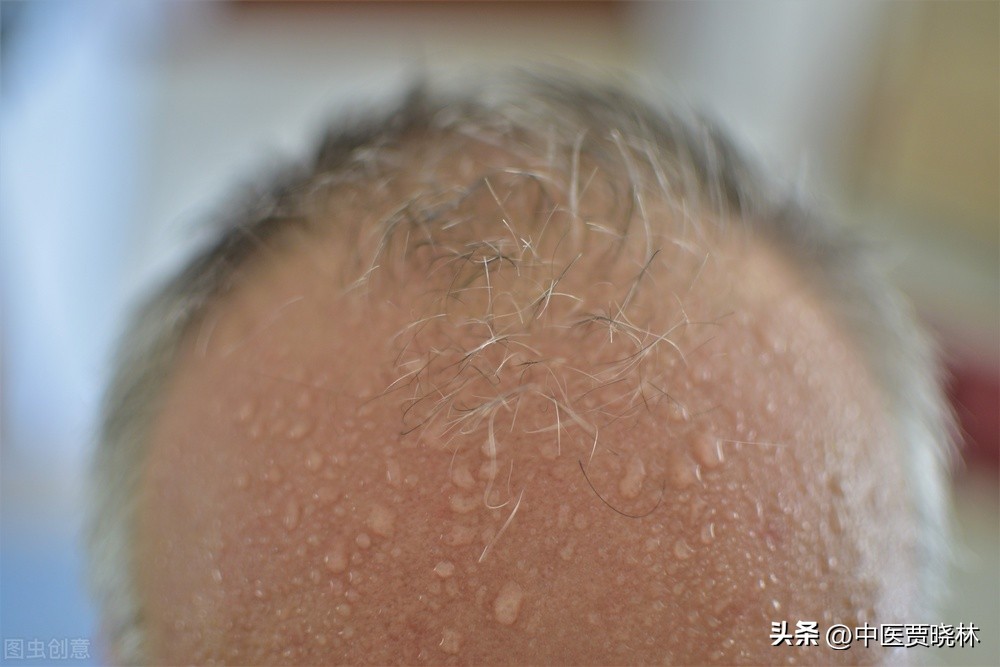 自汗是阳虚还是阴虚吃什么中成药,自汗虚汗多是阴虚还是阳虚