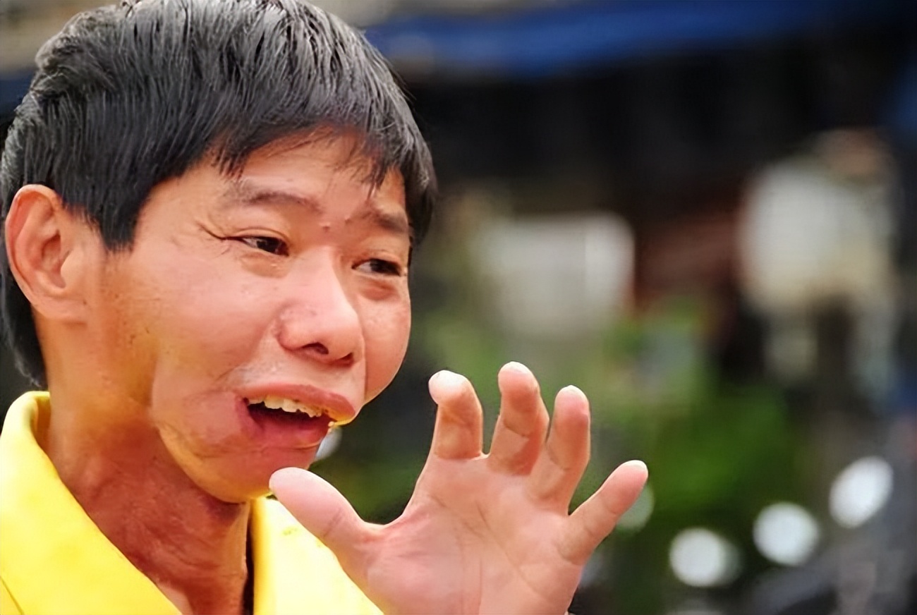 小孩吃槟榔有什么危害,中药槟榔长期吃有危害吗