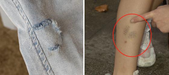 女子小区被狗咬,小区狗咬到人报警警察怎么处理呢