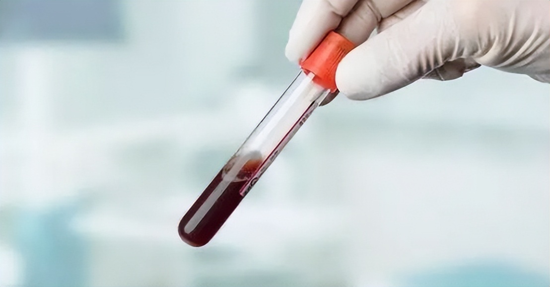 血浆白蛋白低有什么危害,白蛋白对心脏衰竭有用吗