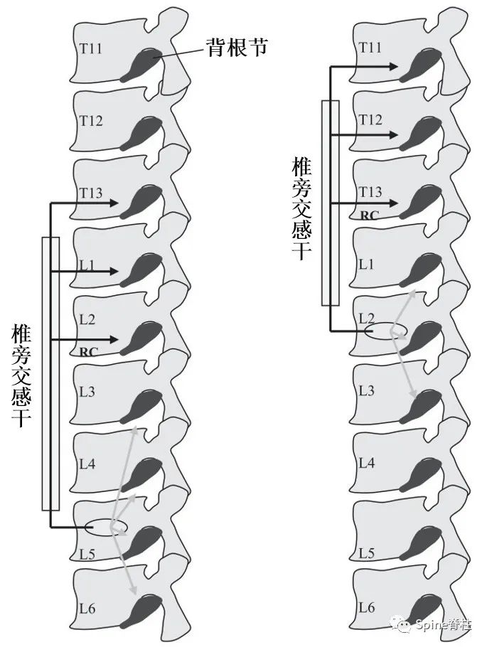 脊柱的神经支配,脊柱神经引起手臂疼痛