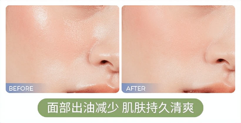 什么面膜清洁毛孔黑头效果好,清洁面膜有用吗真的能清洁毛孔吗