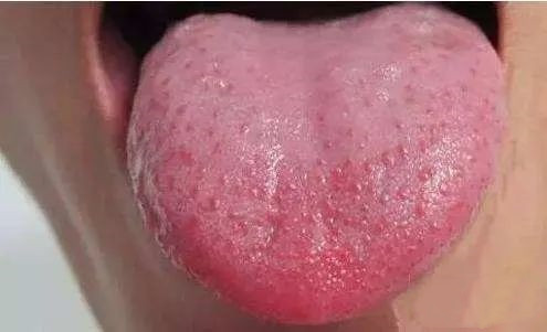 舌诊辨证和精准用药,中医诊病无需诊脉和观舌象靠谱不