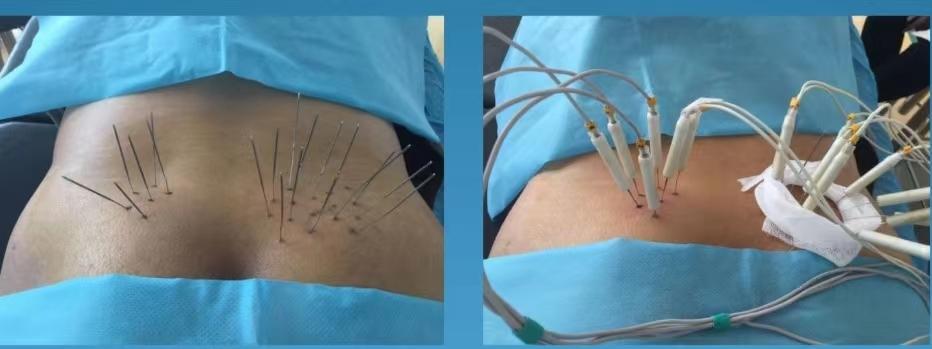 疼痛难忍最好的治疗方法,疼痛难忍的治疗