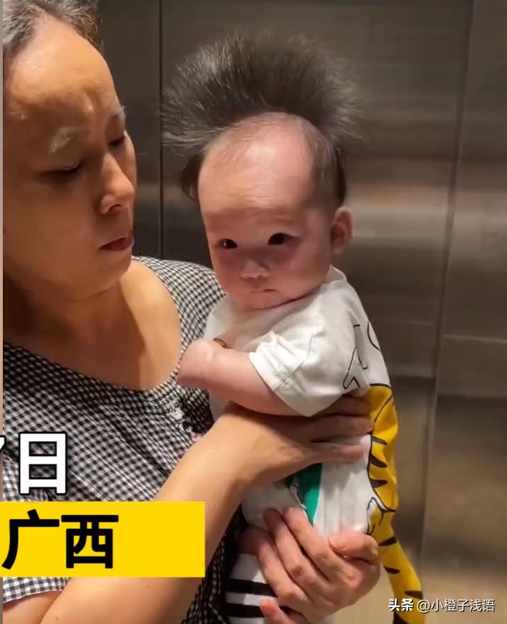 幼儿头发秃顶,幼儿前额秃顶