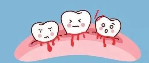 牙龈肿小孩一哭牙龈出血怎么处理,牙龈老是出血用什么老偏方