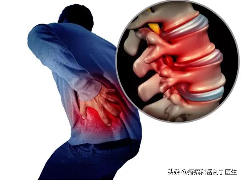 腰痛要警惕四种原因引起,腰痛要警惕四种原因和调理方法