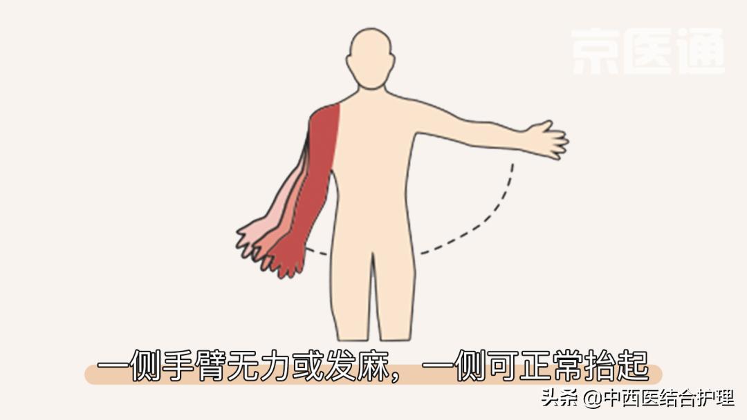 「脑梗病科普」一个周末8个脑梗，他们都有一共同特点！​神药安宫牛黄丸到底能不能救命？