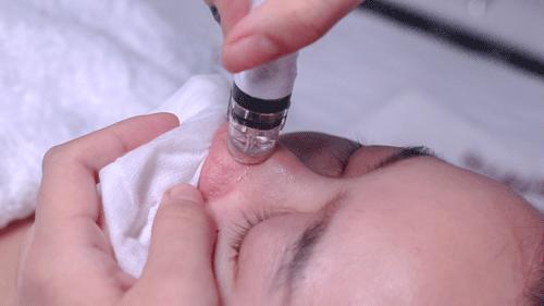 皮肤管理中心仪器选什么好,皮肤管理中心要哪些设备