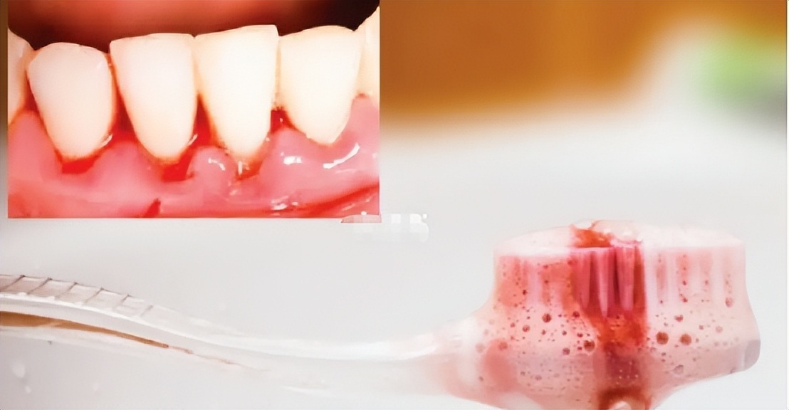 徕芬2023电动牙刷,100以内儿童电动牙刷推荐测评