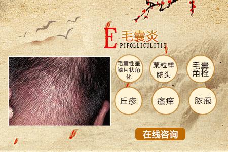 头皮长疙瘩怎么回事怎么解决,头皮上长疙瘩怎么治疗彻底