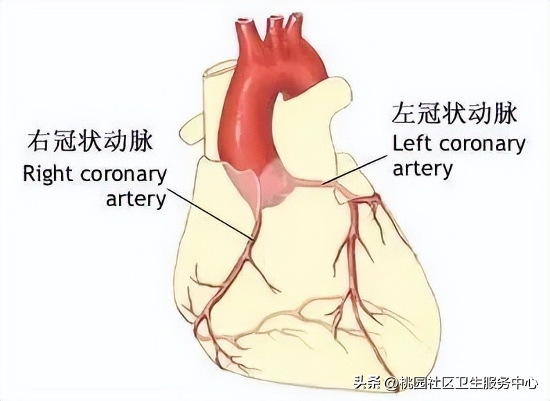 后循环梗死的识别,梗死分为哪三大类型