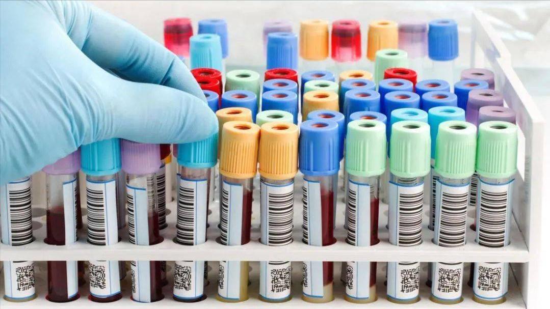 现在看病为什么动不动就要验血,医院里验血抽的血最后都去哪里了