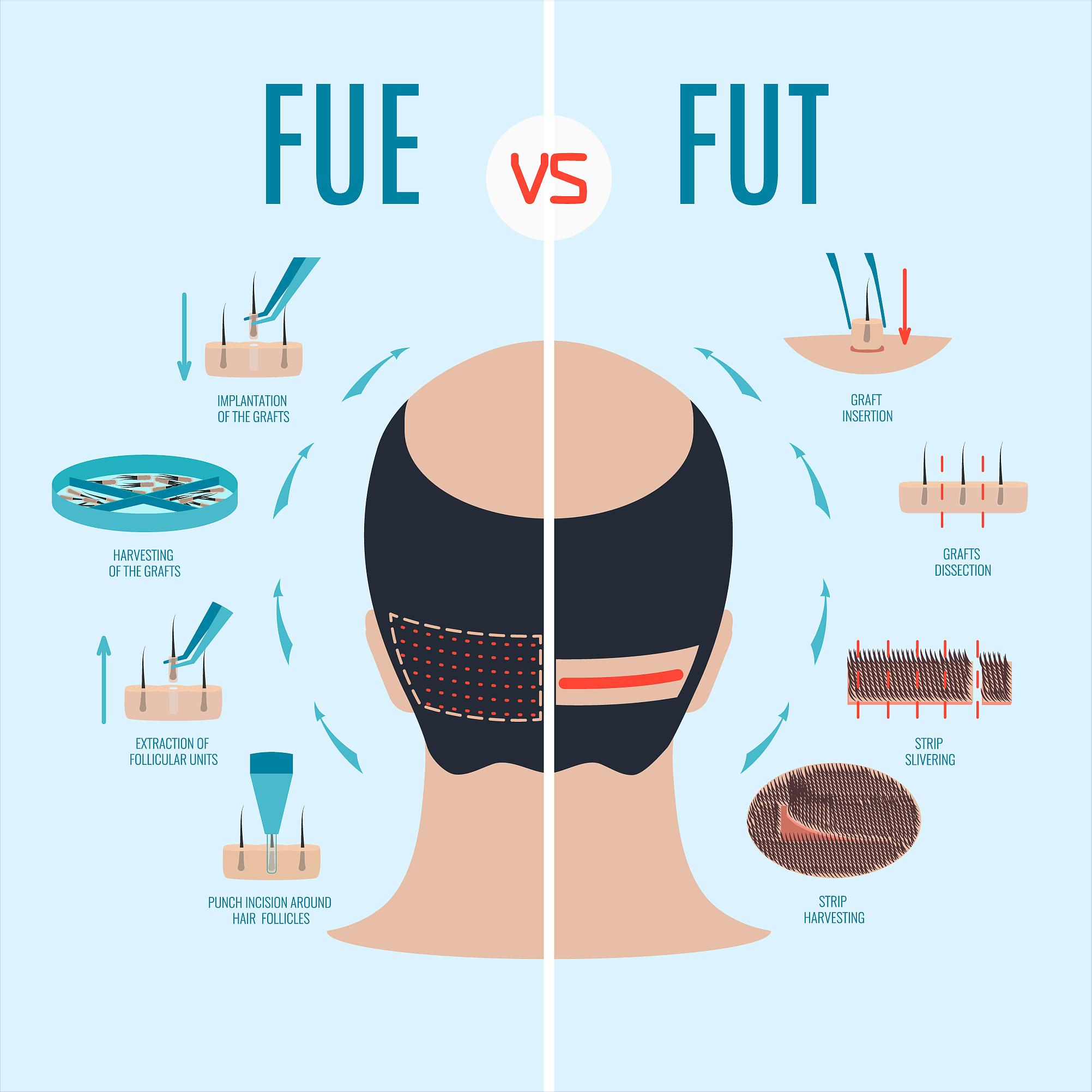 妞嶅彂鏄案涔呯殑杩樻槸鏈夌淮鎸佹椂闂寸殑,璇烽棶妞嶅彂鏈夋晥鍚楄兘缁存寔澶氫箙