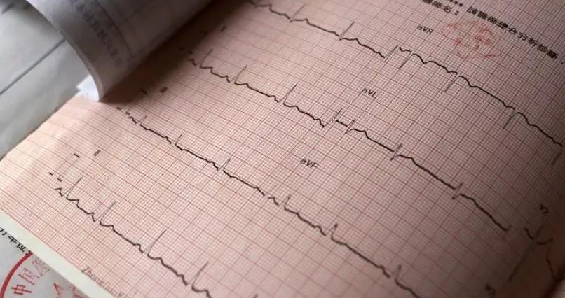 男子喝酒突发心脏病抢救,男子喝药酒突发心脏骤停