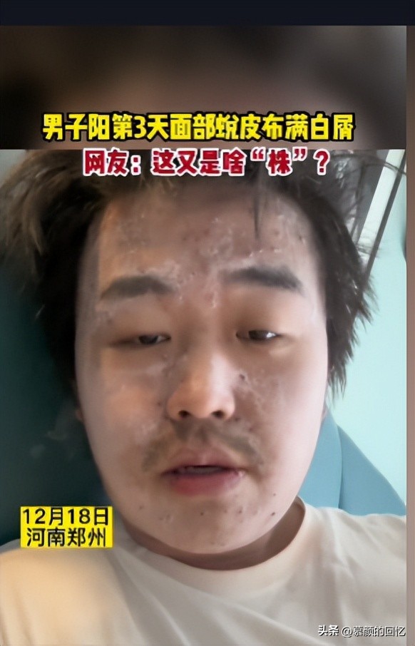 目前的5种毒株,毒株不一样都有哪一种毒株最厉害