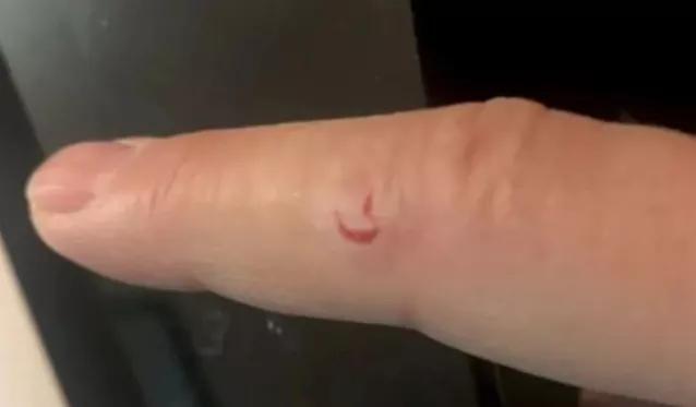 松鼠发狂咬人,松鼠疯狂咬人