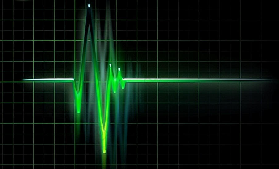 确定全麻手术后马匹心律失常的患病率和性质，评估心律失常的风险