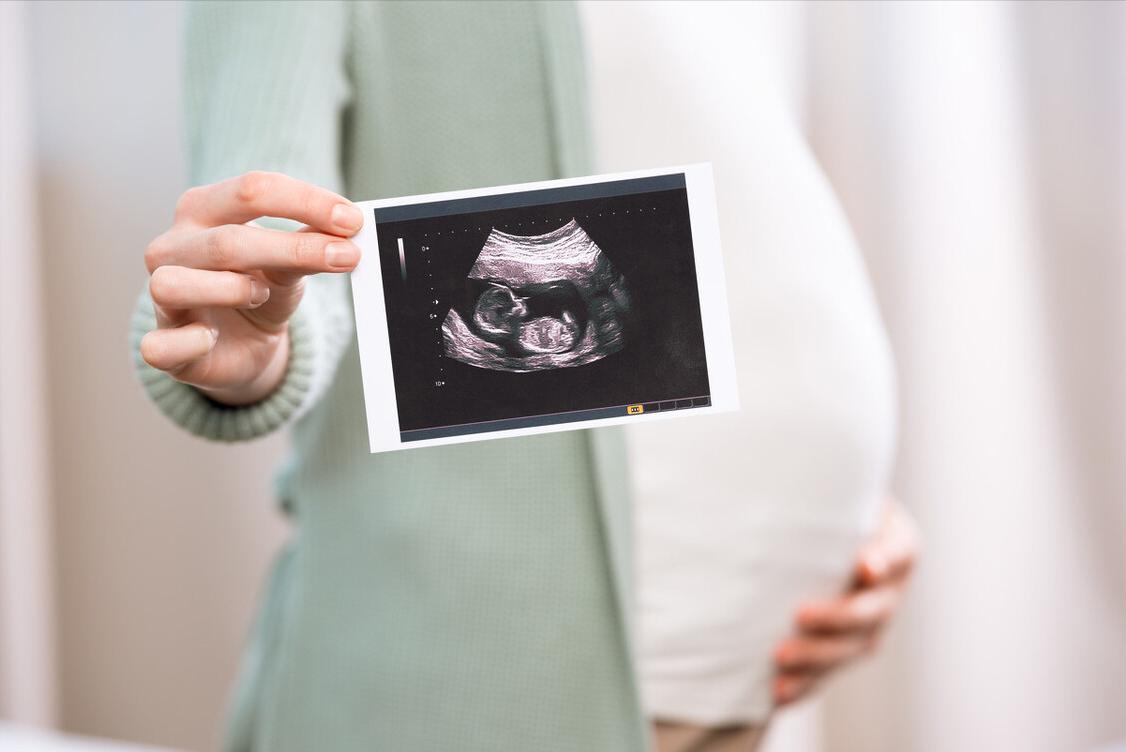 手机里宝宝的照片太多了,手机里最舍不得删的照片宝宝