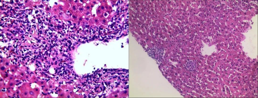 常见梅毒有哪些,病毒性梅毒症状有哪些