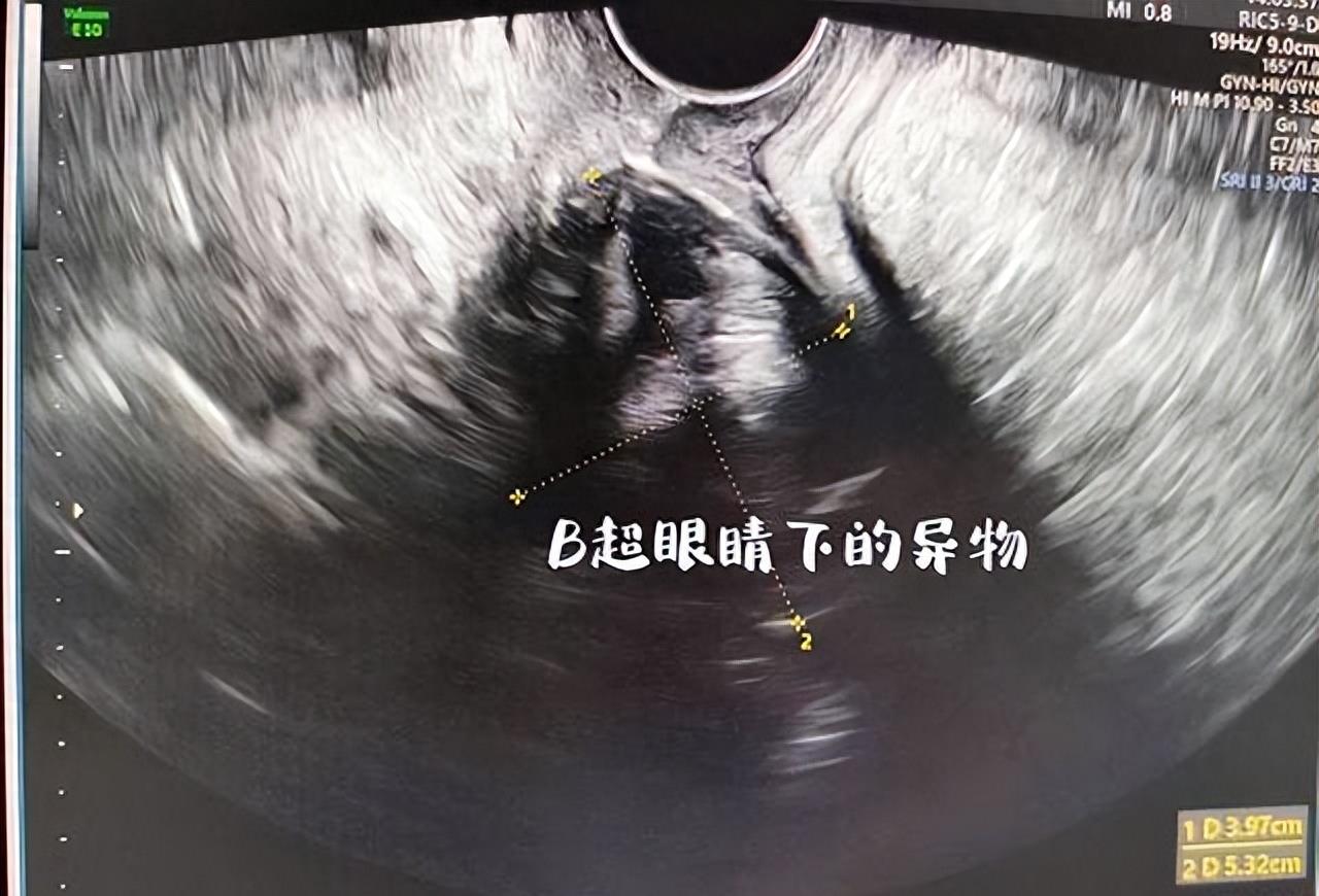 19岁女大学生为寻求刺激,跟男朋友干了一件疯狂的事儿!