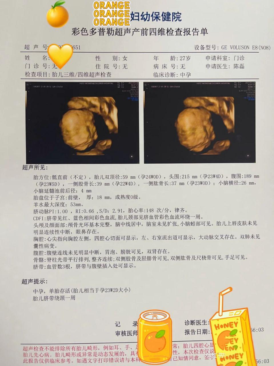 23周做了四维28周还需要再做吗,孕23周四维查出问题还能留吗