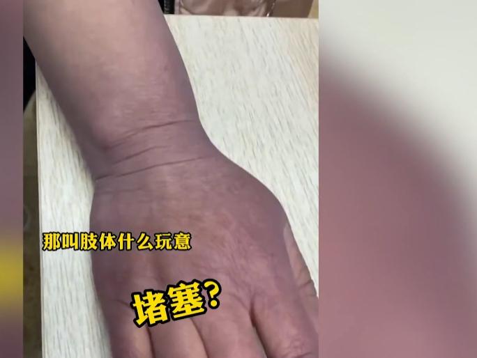 辽宁患者上肢发紫惊恐就医,女子上肢发紫惊恐就医