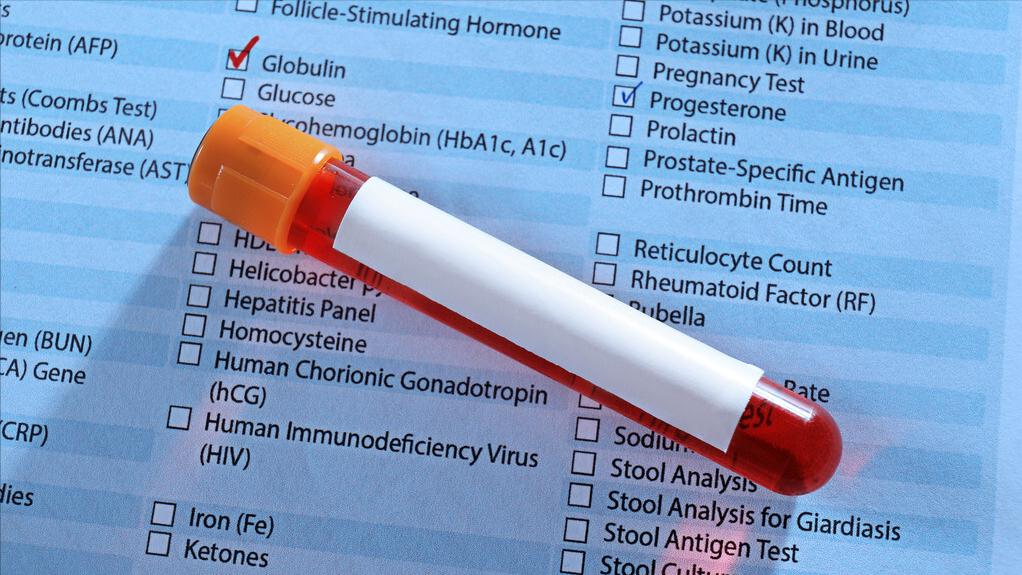 做什么检查可以看出肾病严重程度,要想知道肾有没有问题查什么