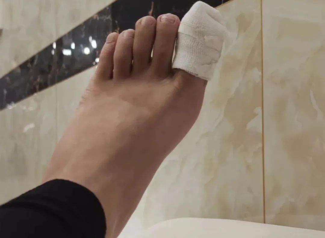 马桶底部密封圈安上去有漏缝,马桶密封圈漏水快速修复妙招