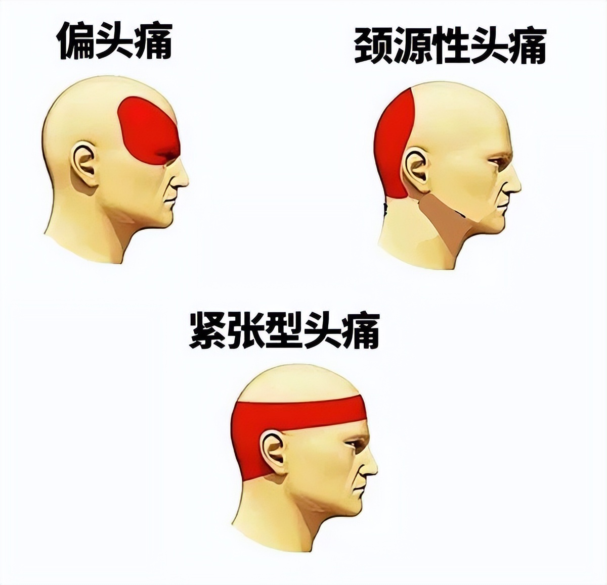 mulligan手法讲解,mulligan手法步骤