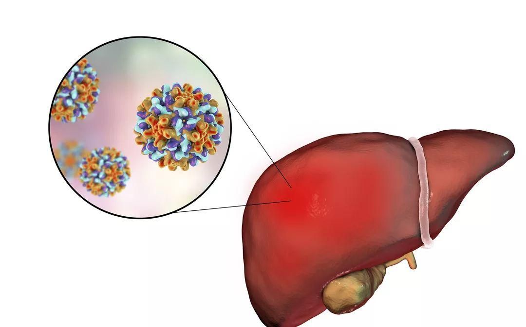 肝炎患者为什么不能吃肉,肝炎患者为什么不能拔牙