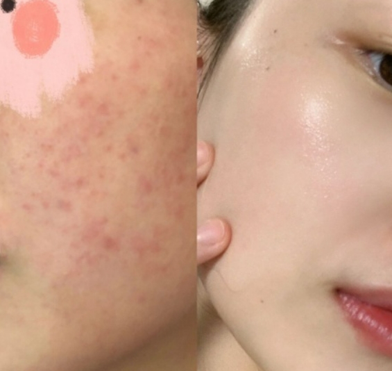 怀孕不能用的护肤品品牌,孕妇可以用的水乳有哪几个品牌