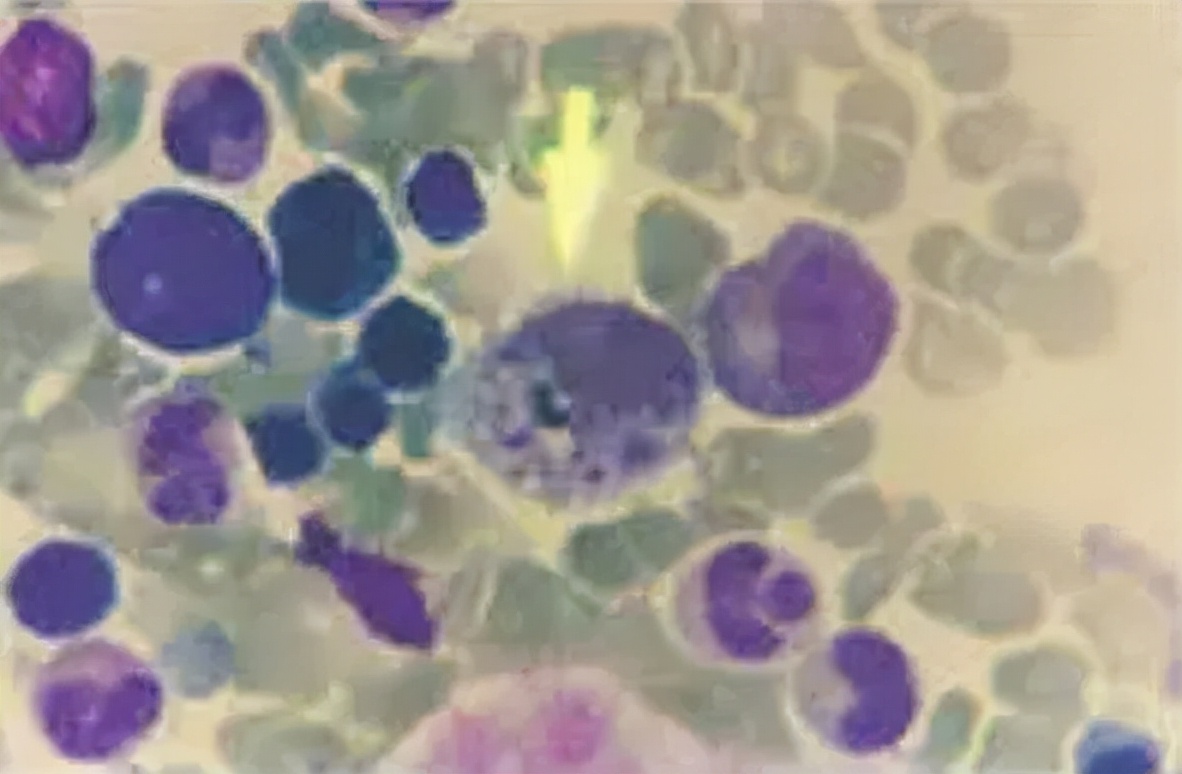 吃草莓会导致出血吗,吃草莓会得炎症吗