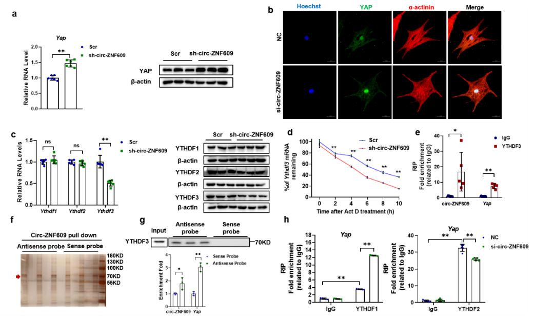 缺血性心脏病能治好么,心肌缺血再灌注诊断和治疗指南