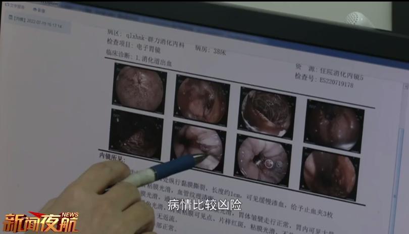 男子喝完冰红茶吐血1000ml,喝完冰镇红茶后吐血