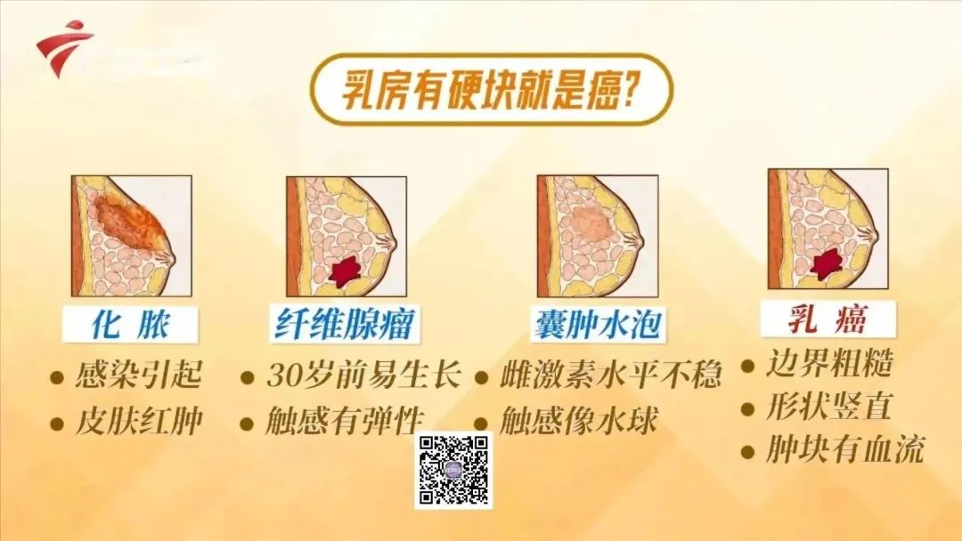 如何自检乳房健康,乳房自检科普知识