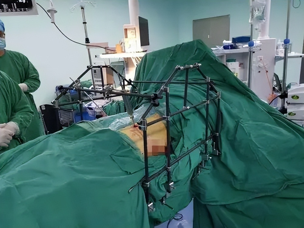 骨盆后环损伤后，新型螺钉的不同内固方法各有何优势？哪种方法好