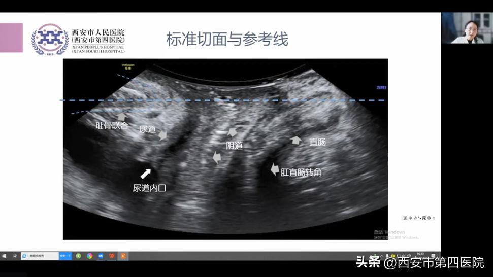 健康中国康复行公益活动,健康中国行动专场