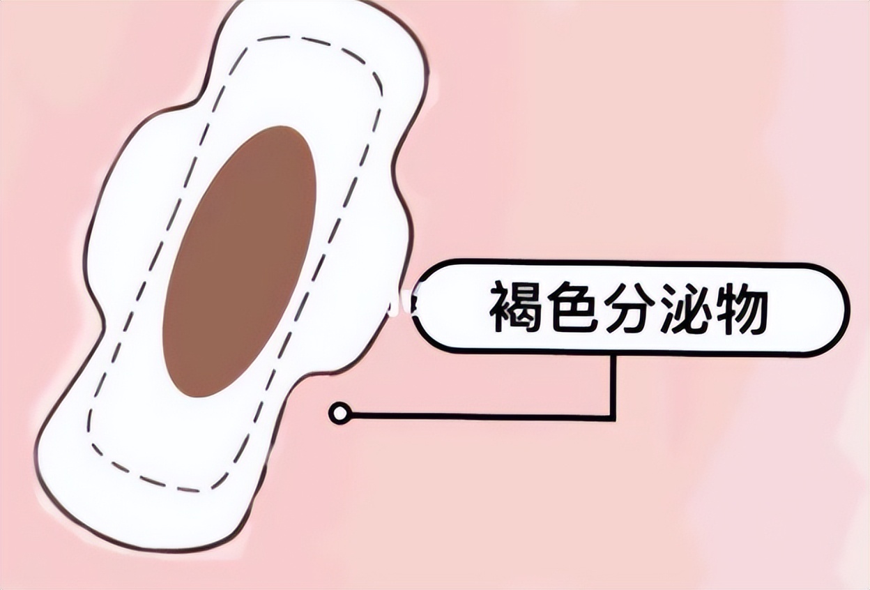 为什么月经结束后，会出现“褐色分泌物”呢？若是你也有，要重视