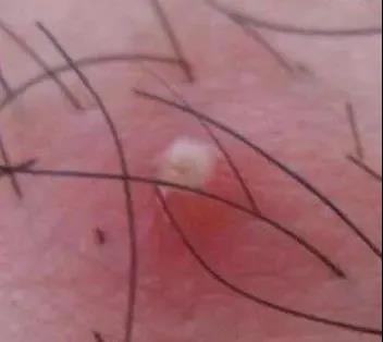 杏林微科普帮您认识各类头晕,杏林微科普养生方法