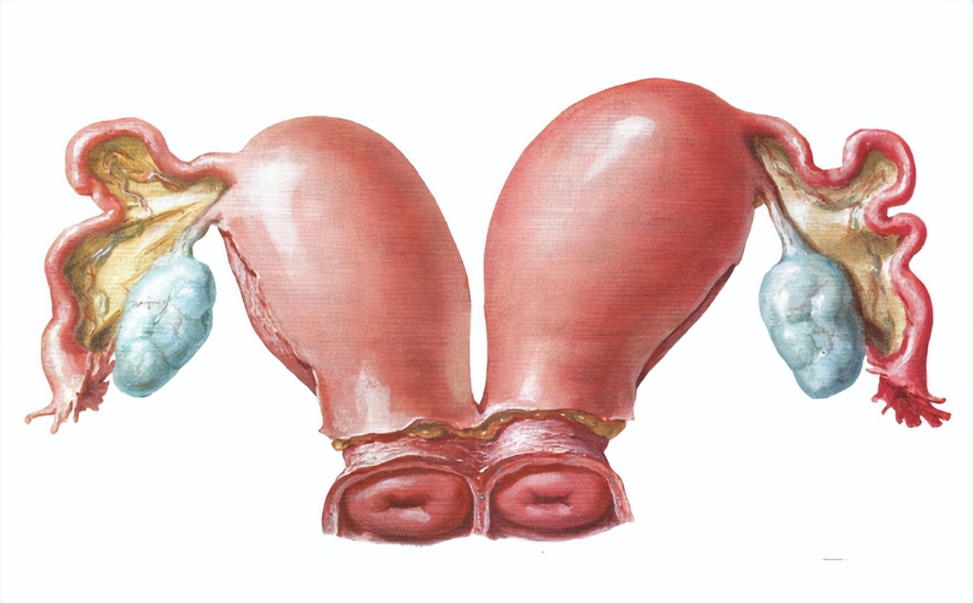 排出两三个卵能否生双胞胎,26岁女子查出双子宫