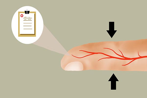 血糖高脚上出现四种变化要注意了,血糖高的人脚上有三种表现