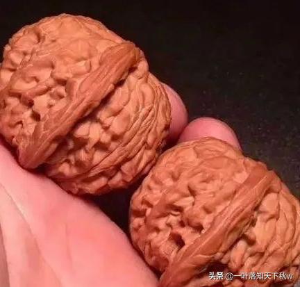 脸盲症犯了,脸盲症又犯了怎么回事