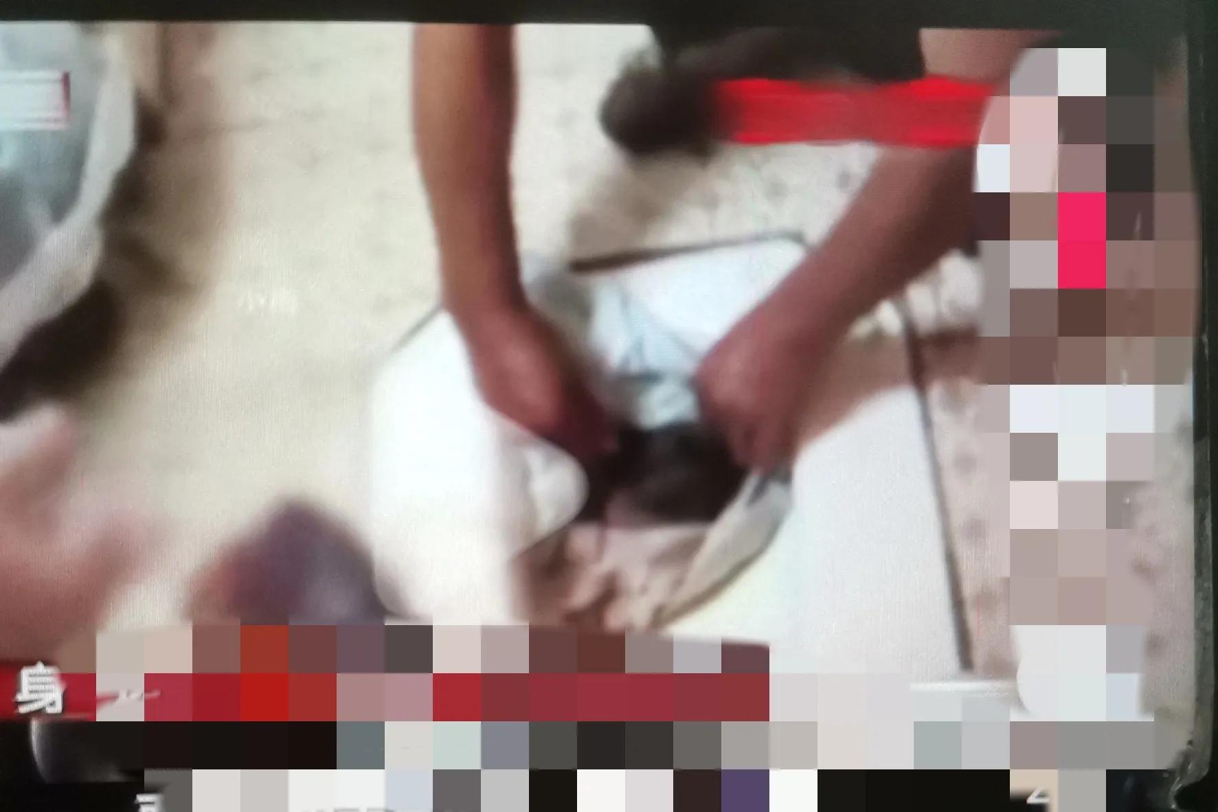 孕妇上厕所太用力,导致胎儿早产,头部卡在便池口不能动弹